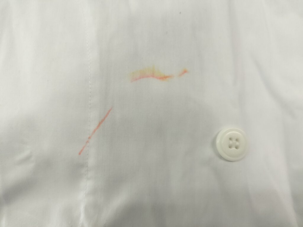 白衣の胸元にオレンジ系の汚れがついている